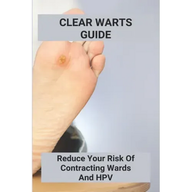 Clear Warts Guide: Reduce Your Risk Of Contracting Wards And Hpv: Does Duct Tape Get Rid Of Warts