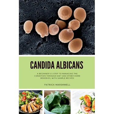 Candida Albicans: A Beginner's 5-Step to Managing the Condition Through Diet and Other Home Remedies, With Sample Recipes