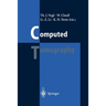 Computed Tomography: State of the Art and Future Applications