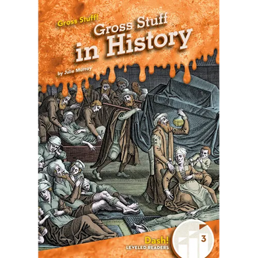 Gross Stuff in History