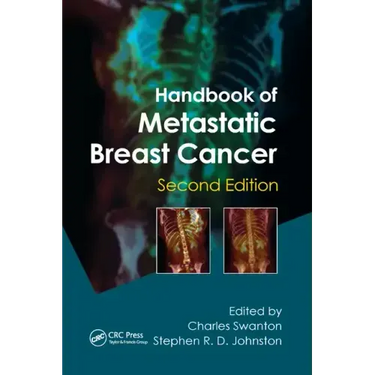 Handbook of Metastatic Breast Cancer
