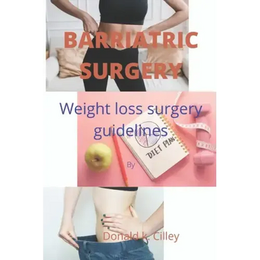 Barriatric Surgery: Weight loss surgery guidelines