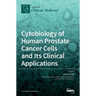 Cytobiology of Human Prostate Cancer Cells and Its Clinical Applications