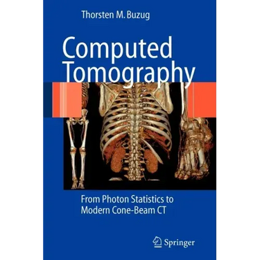 Computed Tomography: From Photon Statistics to Modern Cone-Beam CT