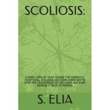 Scoliosis: : A Fresh Look at What Causes the Idiopathic Functional Scoliosis and Home Exercises to Stop the Progression of the Cu