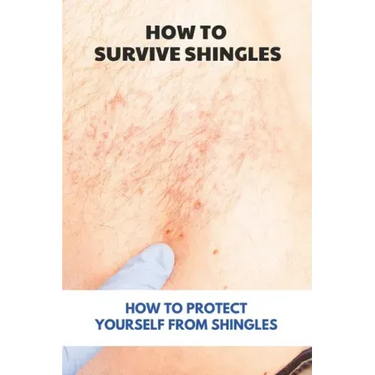 How To Survive Shingles: How To Protect Yourself From Shingles: How To Speed Up Shingles Recovery