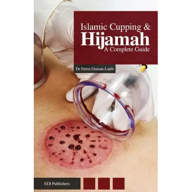 Islamic Cupping & Hijamah: A Complete Guide