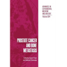 Prostate Cancer and Bone Metastasis