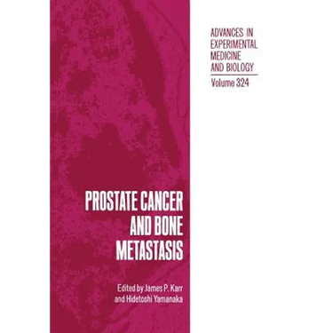 Prostate Cancer and Bone Metastasis