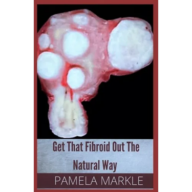 Get That Fibroid Out the Natural Way