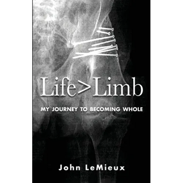 Life is Greater Than Limb: My Journey to Becoming Whole