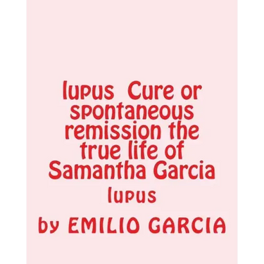lupus Cure or spontaneous remission the true life of Samantha Garcia: lupus