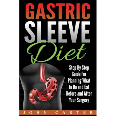 Gastric Sleeve Diet: Step By Step Guide For Planning What to Do and Eat Before and After Your Surgery