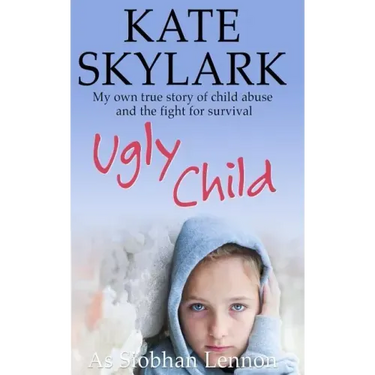Ugly Child: My Own True Story of Child Abuse and the Fight for Survival