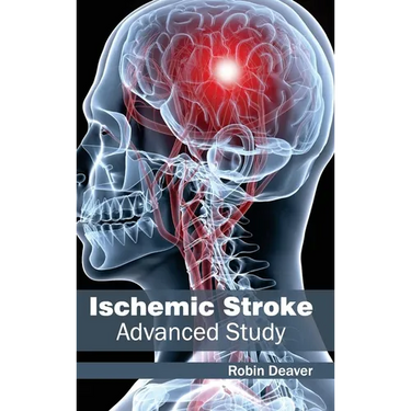 Ischemic Stroke: Advanced Study