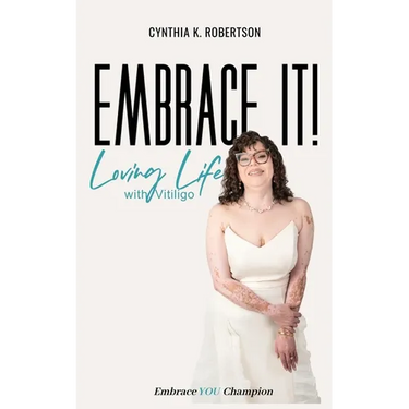 Embrace It: Loving Life with Vitiligo