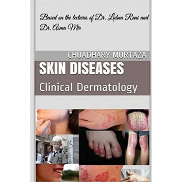 Skin Diseases: Clinical Dermatology