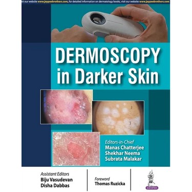 Dermoscopy in Darker Skin