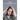 Help! I'm Losing My Hair: Hair Loss - You Can Treat It