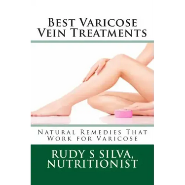 Best Varicose Vein Treatments: Natural Remedies That Work For Varicose
