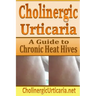 Cholinergic Urticaria: A Guide to Chronic Heat Hives