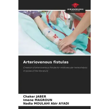 Arteriovenous fistulas