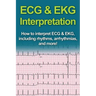 ECG & EKG Interpretation: How to interpret ECG & EKG, including rhythms, arrhythmias, and more!