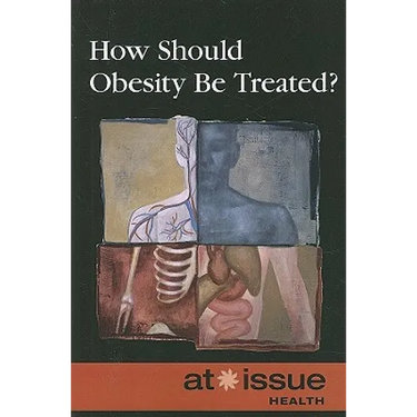 How Should Obesity Be Treated?