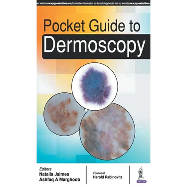 Pocket Guide to Dermoscopy