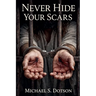 Never Hide Your Scars