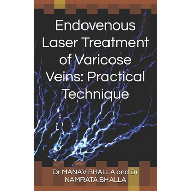 Endovenous Laser Treatment of Varicose Veins: Practical Technique