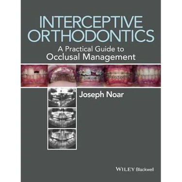 Interceptive Orthodontics: A Practical Guide to Occlusal Management