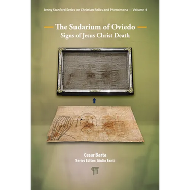 The Sudarium of Oviedo: Signs of Jesus Christ's Death