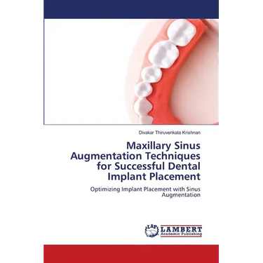 Maxillary Sinus Augmentation Techniques for Successful Dental Implant Placement