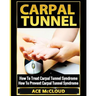 Carpal Tunnel: How To Treat Carpal Tunnel Syndrome: How To Prevent Carpal Tunnel Syndrome