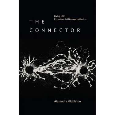 The Connector: Living with Experimental Neuroprosthetics