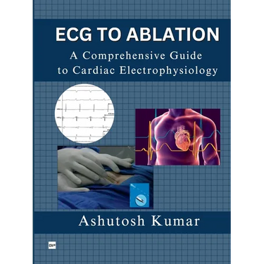 ECG to Ablation: A Comprehensive Guide to Cardiac Electrophysiology