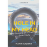 Hole in My Head: The Blessing of a Traumatic Brain Injury