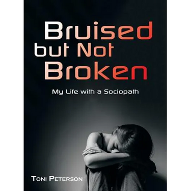 Bruised but Not Broken: My Life with a Sociopath