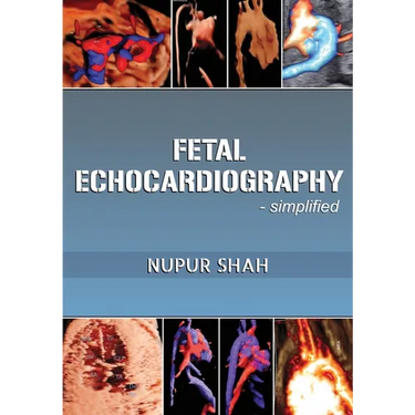 Fetal Echocardiography - Simplified