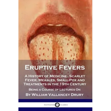 Eruptive Fevers: A History of Medicine - Scarlet Fever, Measles, Small-Pox and Treatments in the 19th Century - Being a Course of Lectures On