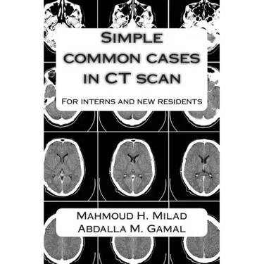 Simple common cases in CT scan: For interns and new residents