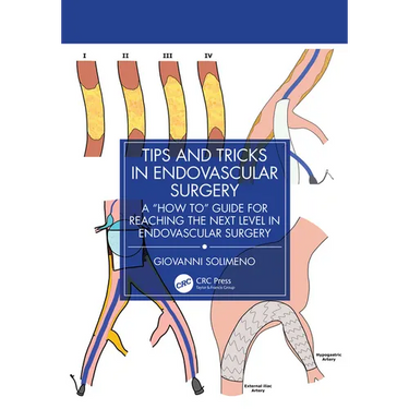 Tips and Tricks in Endovascular Surgery: A "How to" Guide for reaching the next Level in Endovascular Surgery