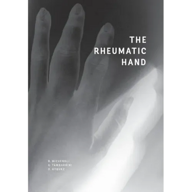 The Rheumatic Hand