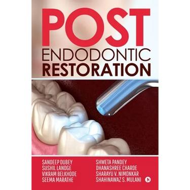 Post Endodontic Restoration