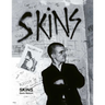 Skins: Gavin Watson