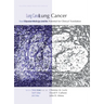 Lung Cancer: Disease Biology and Its Potential for Clinical Translation
