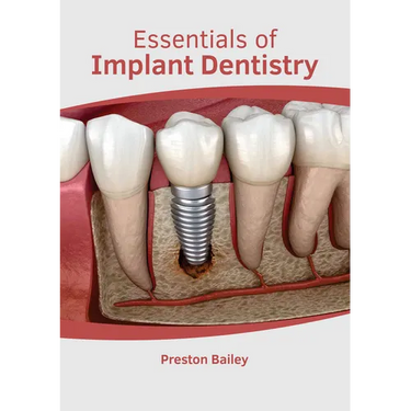 Essentials of Implant Dentistry