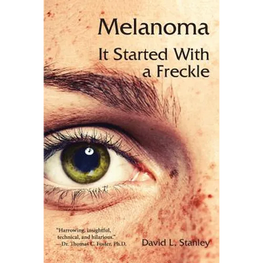 Melanoma: It Started With a Freckle