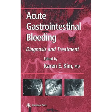 Acute Gastrointestinal Bleeding: Diagnosis and Treatment